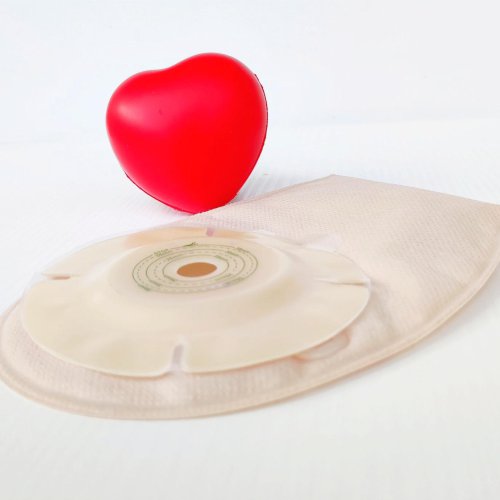 Zarastanie stomii  czy da się go uniknąć?