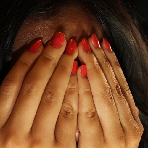 Bardzo głośna stomia, czy to już na zawsze?