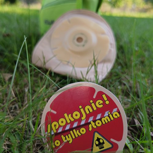 Wynicowanie stomii, co to?