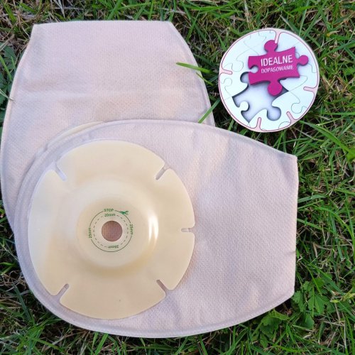 Wielkość stomii – ta sama na zawsze?